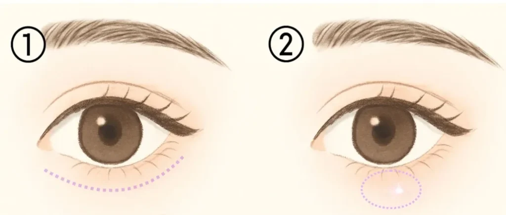 涙袋のメイクのイメージイラスト
